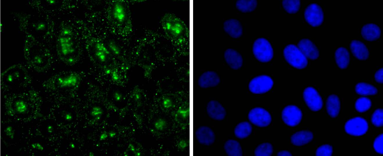 Histone H3 (mono methyl R2) Antibody