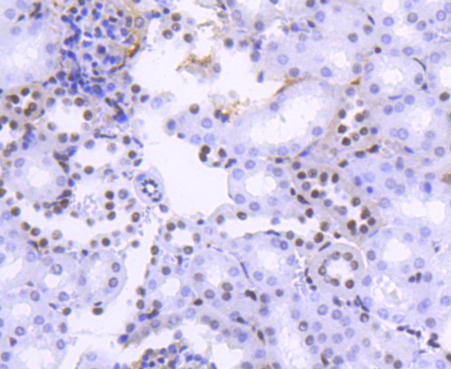 Histone H2B(acetyl K20) Antibody