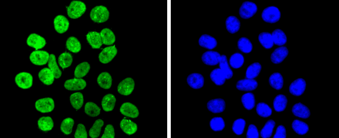 Histone H3(di methyl K9) Antibody