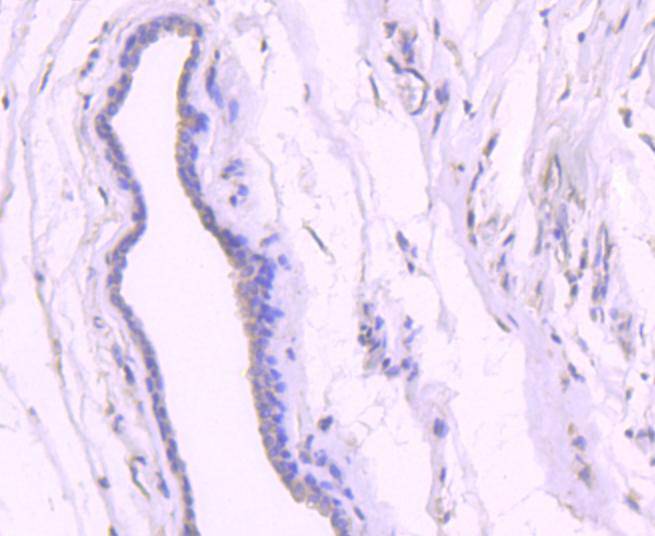 p53 (acetyl K382) Antibody