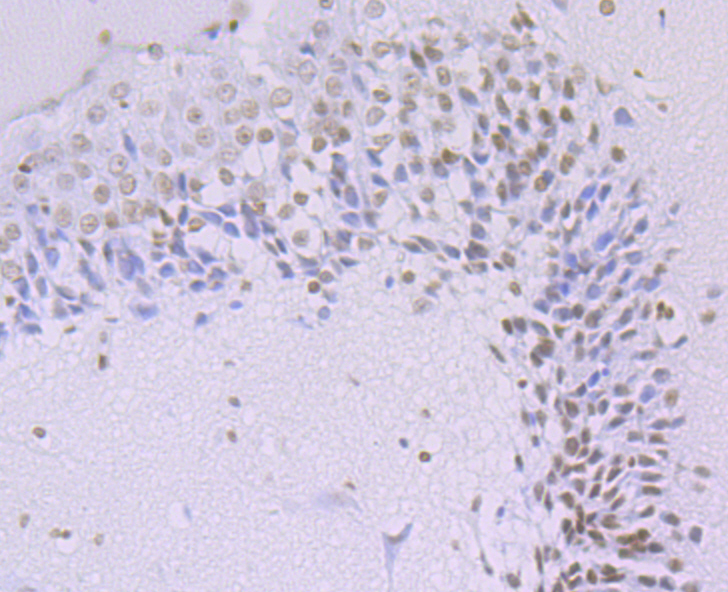 Histone H3 (acetyl K14) Antibody