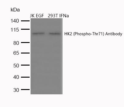 HK2 (Phospho-Thr71) Antibody
