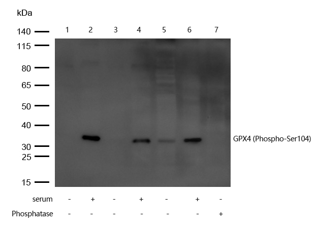 GPX4 (Phospho-Ser104) Antibody
